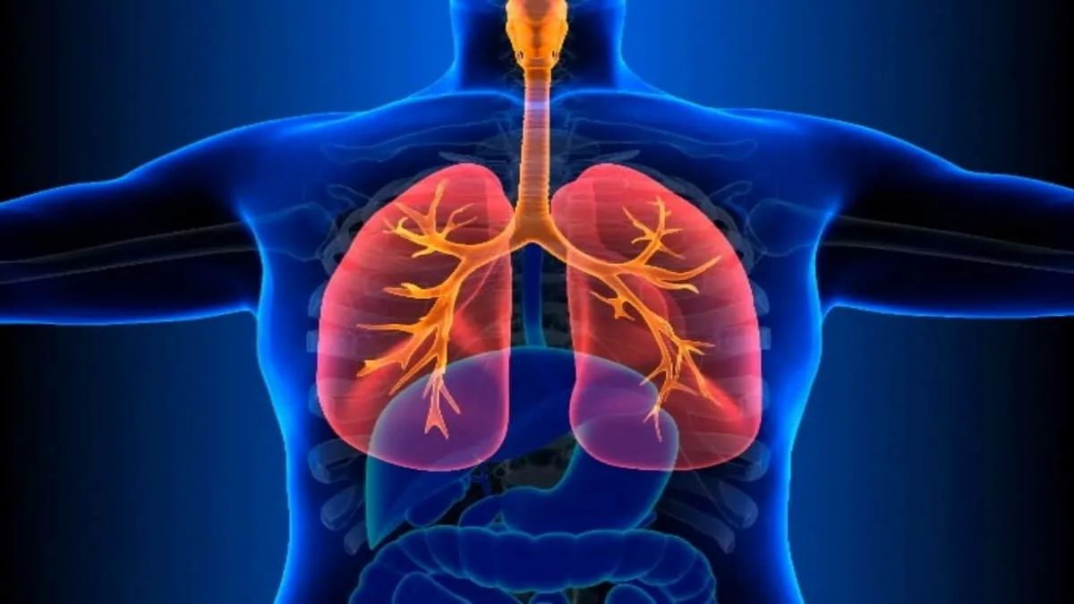 Kasus TBC di Kota Bandung Mencapai 18 Ribu Lebih