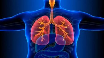 Kasus TBC di Kota Bandung Mencapai 18 Ribu Lebih